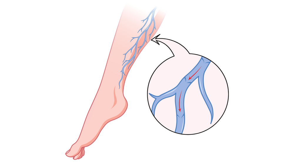 Compression Socks: What are they and who do they benefit? – Dr. Segal's